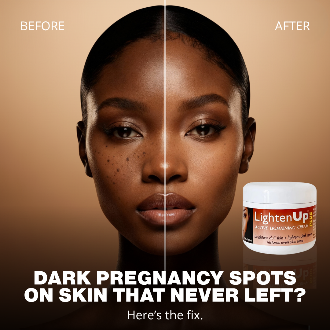LightenUp before-and-after: dark pregnancy spots brightening cream ad