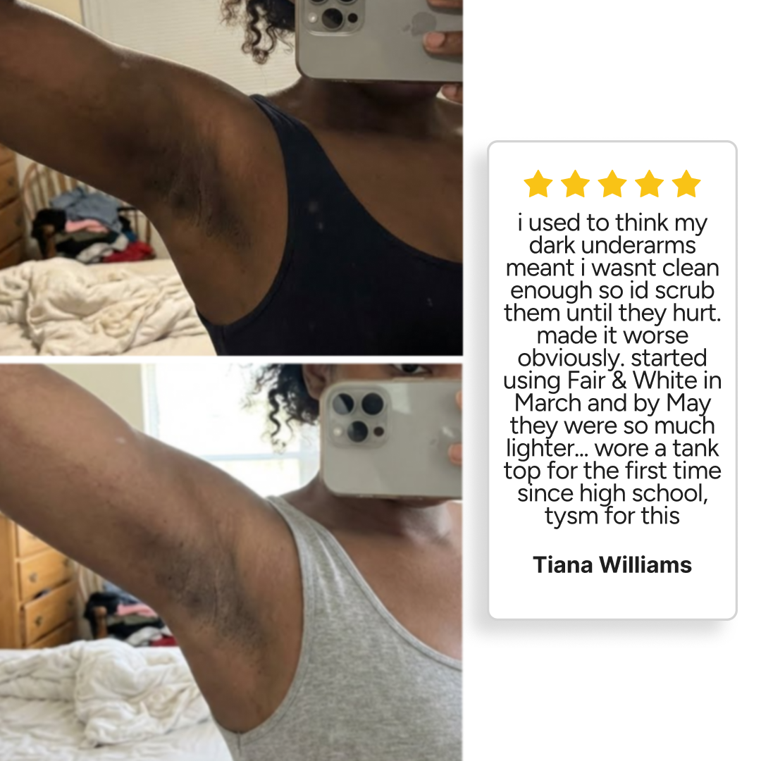 Fair & White dark-spot review ad